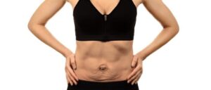 Causas y factores de riesgo la diástasis abdominal
