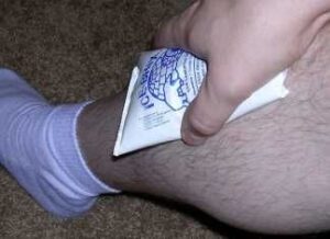 ¿Cuál es el tratamiento de la Periostitis Tibial?